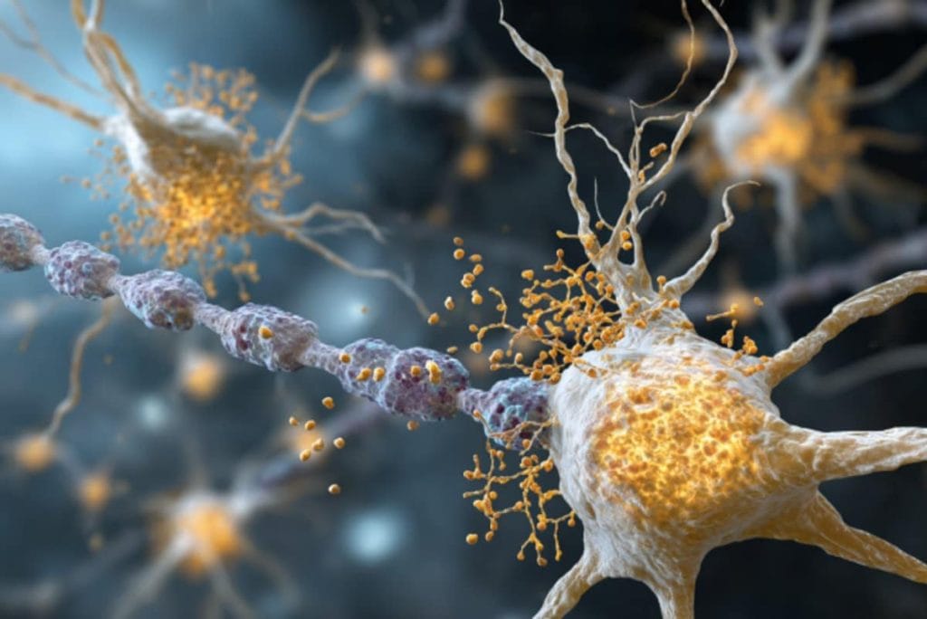 This shows healthy microglia and neurons.