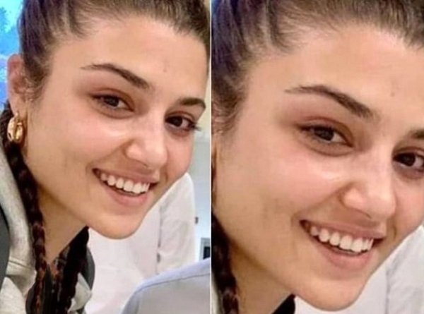 عکس هانده ارچل بدون آرایش؛ جذاب و طبیعی بی‌نظیر