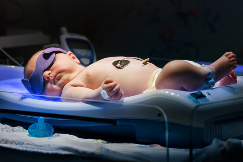 لامپ فتوتراپی